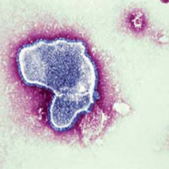 D68 İsimli Çocuk Felci Virüsüne Akraba Bir Virüs ABD’de Çocuklarda Solunum Yolu Hastalığı Şeklinde Ortaya Çıktı