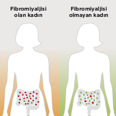 Fibromiyalji Hastalığında Yeni Ufuklar